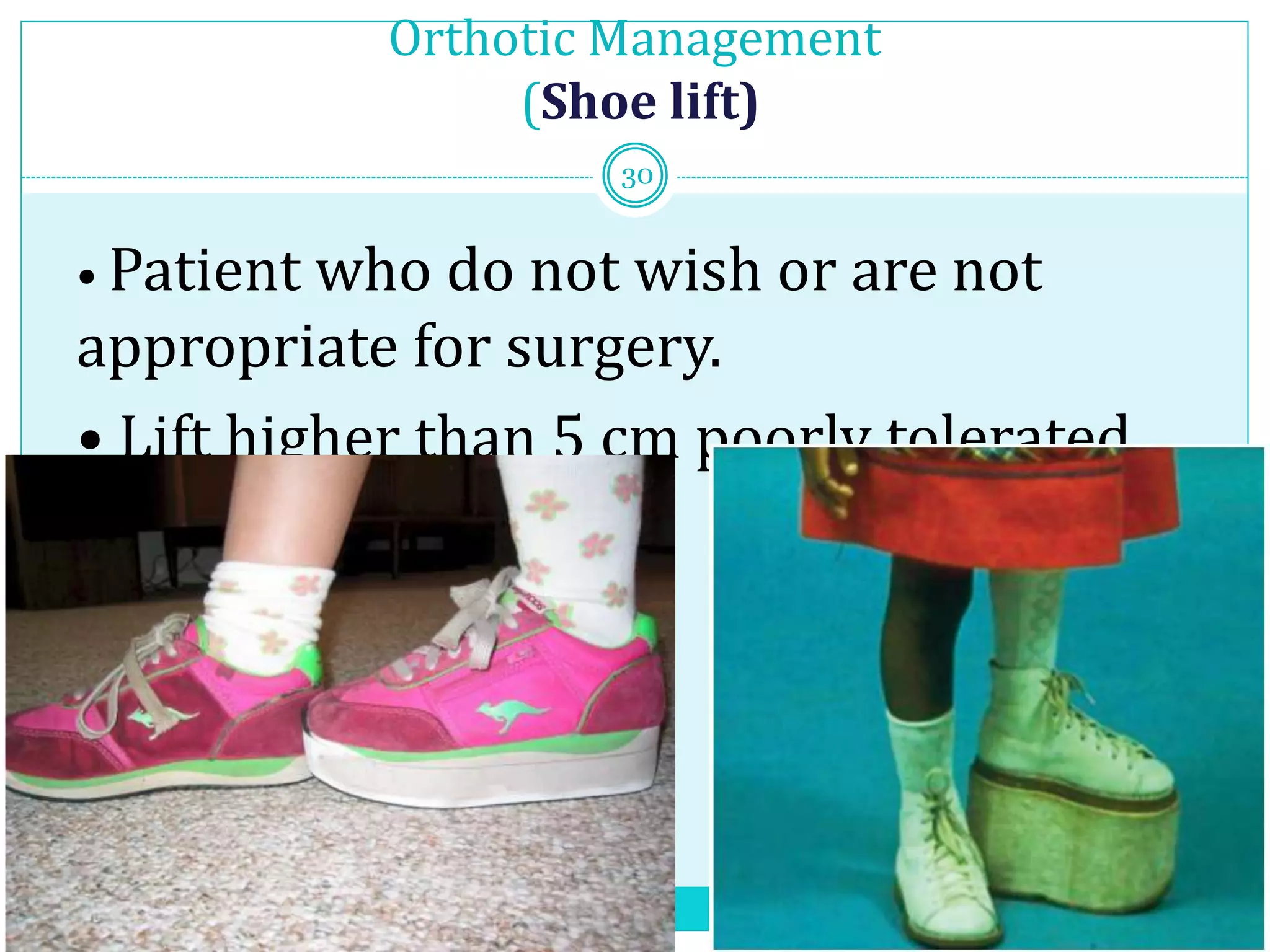 Orthotic Management
(Shoe lift)
• Patient who do not wish or are not
appropriate for surgery.
• Lift higher than 5 cm poorly tolerated
30
 