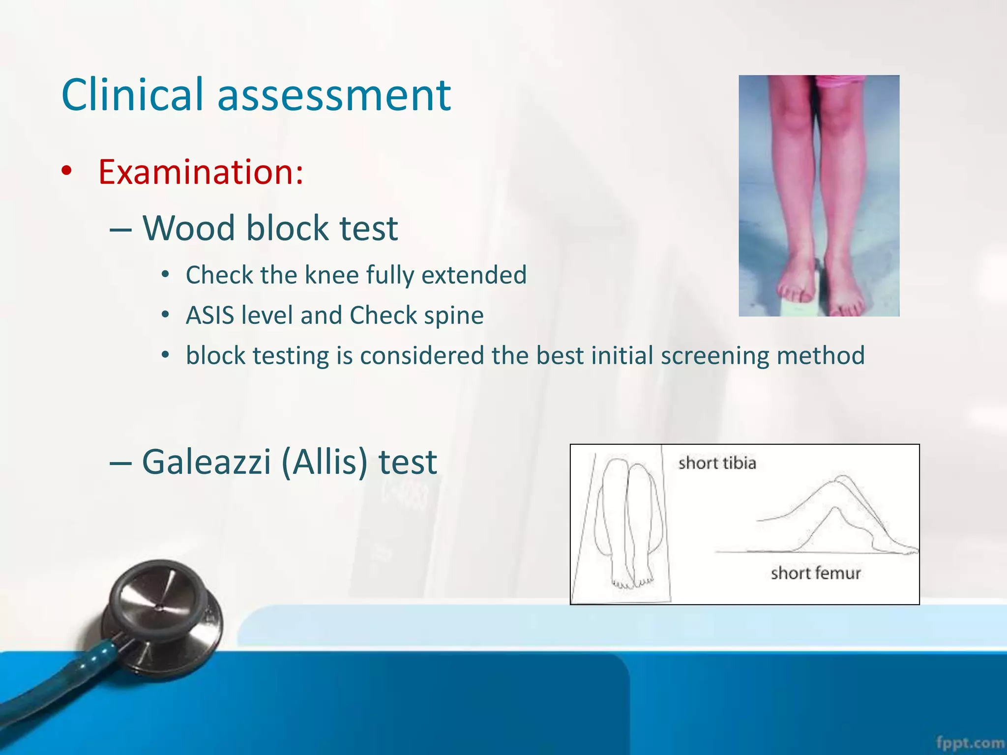 Clinical assessment
• Examination:
– Wood block test
• Check the knee fully extended
• ASIS level and Check spine
• block testing is considered the best initial screening method
– Galeazzi (Allis) test
 