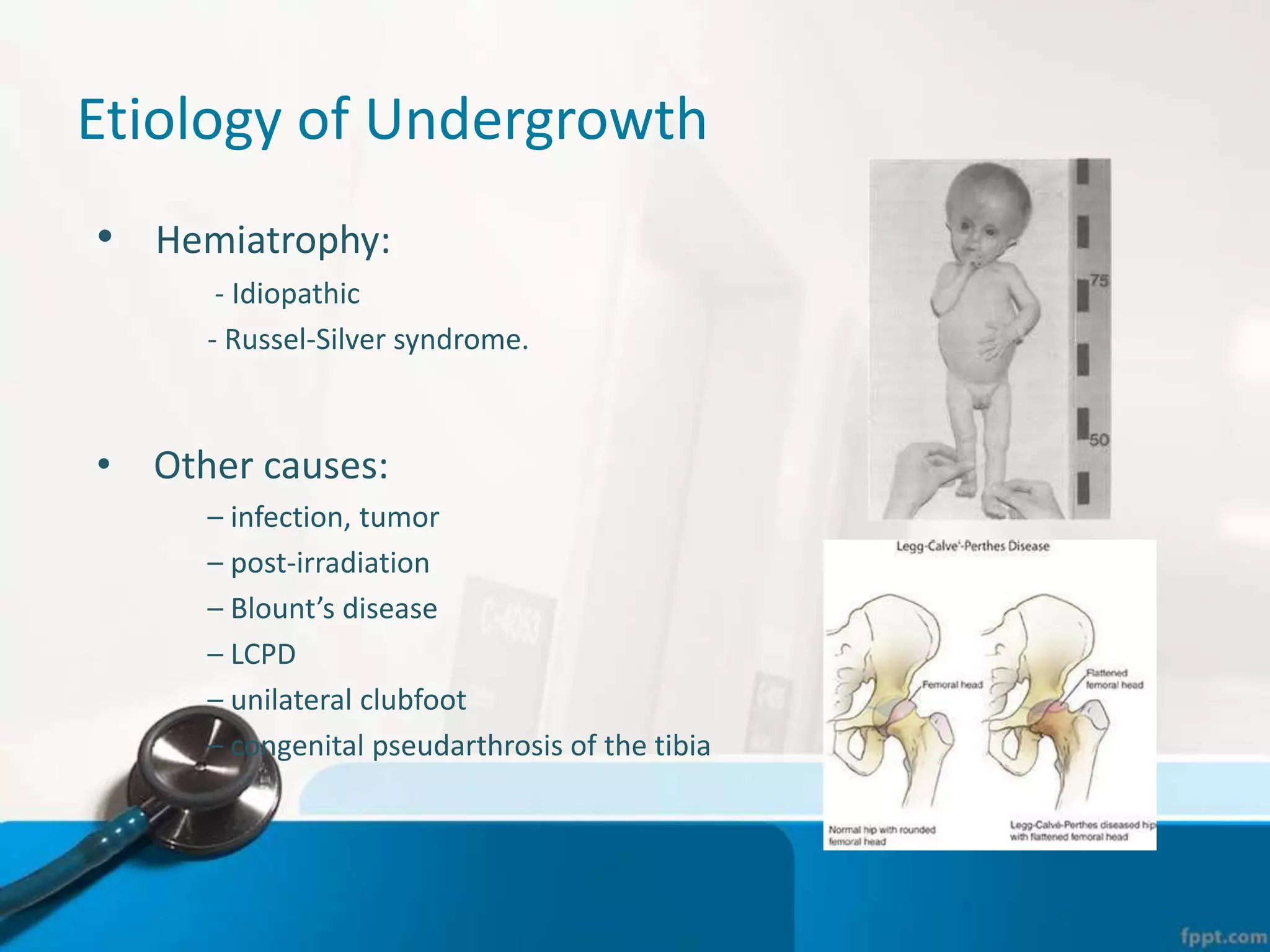 Etiology of Undergrowth
• Hemiatrophy:
- Idiopathic
- Russel-Silver syndrome.
• Other causes:
– infection, tumor
– post-irradiation
– Blount’s disease
– LCPD
– unilateral clubfoot
– congenital pseudarthrosis of the tibia
 