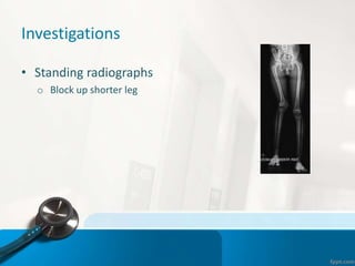 Investigations
• Standing radiographs
o Block up shorter leg
 