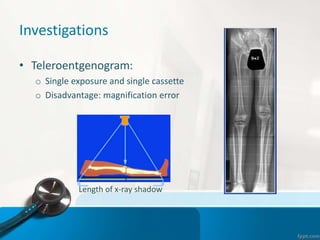 Investigations
• Teleroentgenogram:
o Single exposure and single cassette
o Disadvantage: magnification error
Length of x-ray shadow
 