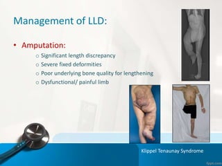 Management of LLD:
• Amputation:
o Significant length discrepancy
o Severe fixed deformities
o Poor underlying bone quality for lengthening
o Dysfunctional/ painful limb
Klippel Tenaunay Syndrome
 