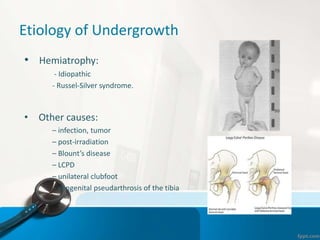 Etiology of Undergrowth
• Hemiatrophy:
- Idiopathic
- Russel-Silver syndrome.
• Other causes:
– infection, tumor
– post-irradiation
– Blount’s disease
– LCPD
– unilateral clubfoot
– congenital pseudarthrosis of the tibia
 