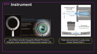 Limbal Relaxing Incisions fix2.pptx
