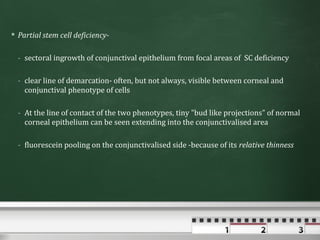  Partial stem cell deficiency-

  - sectoral ingrowth of conjunctival epithelium from focal areas of SC deficiency

  - clear line of demarcation- often, but not always, visible between corneal and
    conjunctival phenotype of cells

  - At the line of contact of the two phenotypes, tiny "bud like projections" of normal
    corneal epithelium can be seen extending into the conjunctivalised area

  - fluorescein pooling on the conjunctivalised side -because of its relative thinness
 