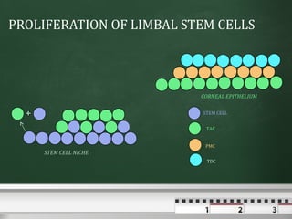 PROLIFERATION OF LIMBAL STEM CELLS




                          CORNEAL EPITHELIUM

                          STEM CELL


                           TAC


                           PMC
    STEM CELL NICHE
                           TDC
 