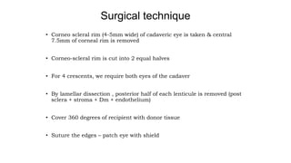 Surgical technique
• Corneo scleral rim (4-5mm wide) of cadaveric eye is taken & central
7.5mm of corneal rim is removed
• Corneo-scleral rim is cut into 2 equal halves
• For 4 crescents, we require both eyes of the cadaver
• By lamellar dissection , posterior half of each lenticule is removed (post
sclera + stroma + Dm + endothelium)
• Cover 360 degrees of recipient with donor tissue
• Suture the edges – patch eye with shield
 