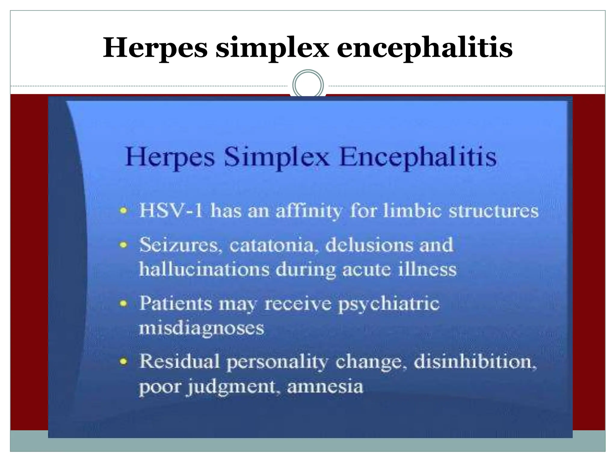 Herpes simplex encephalitis
 