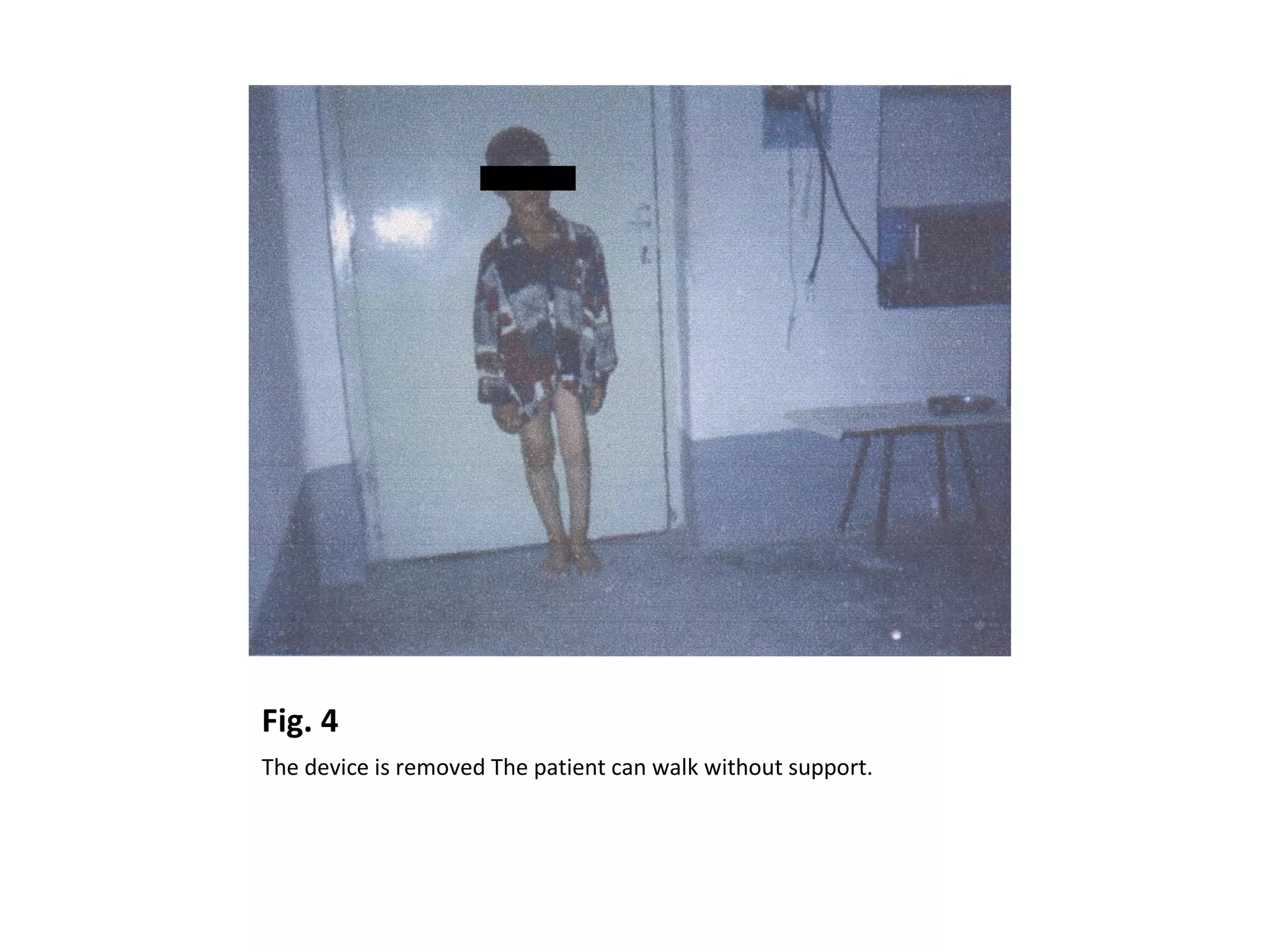 Fig. 4
The device is removed The patient can walk without support.
 