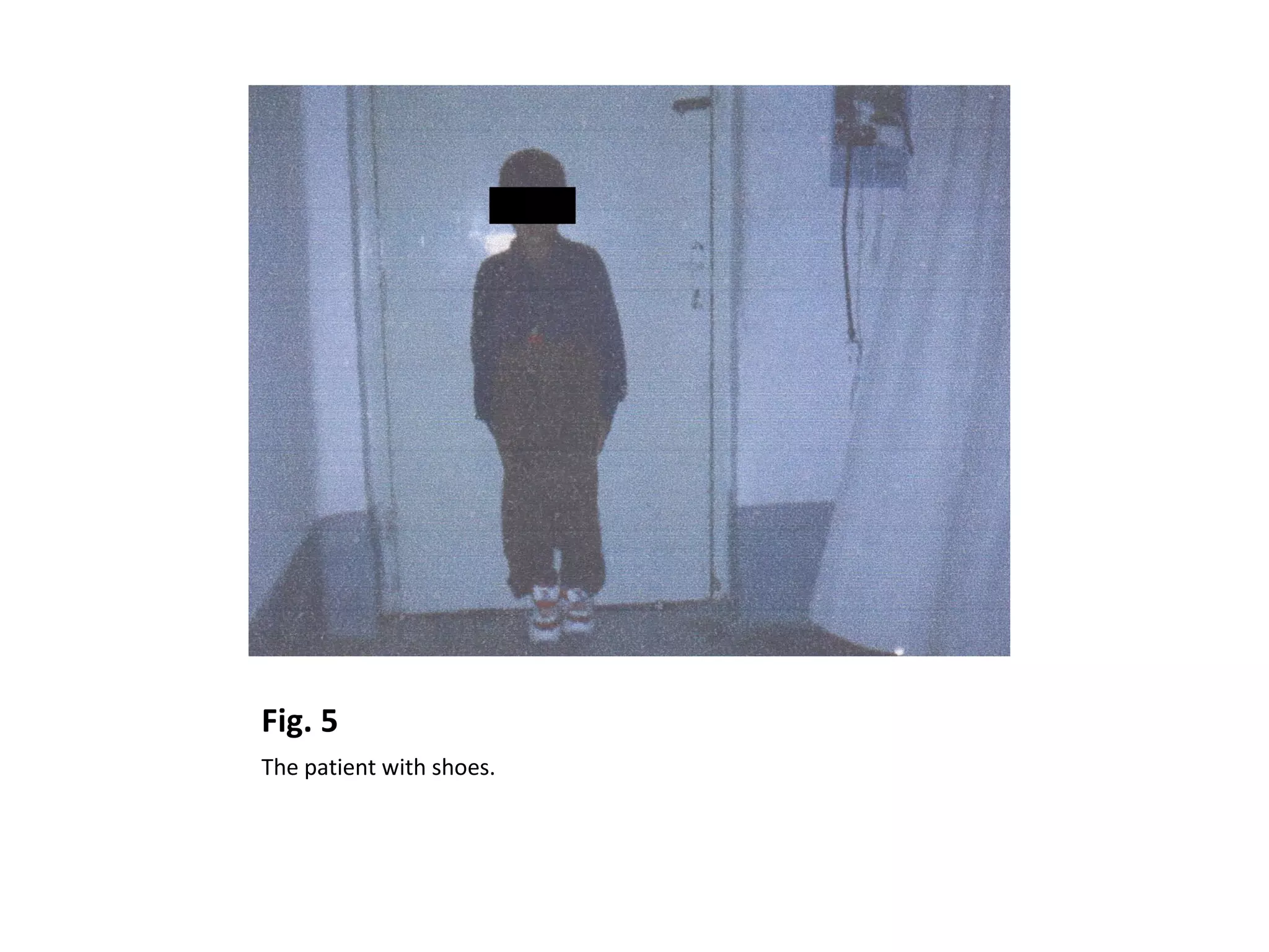 Fig. 5
The patient with shoes.
 