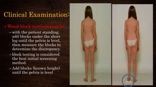Clinical Examination:
• Wood block test(coleman’s):
– with the patient standing,
add blocks under the short
leg until the pelvis is level,
then measure the blocks to
determine the discrepancy.
– block testing is considered
the best initial screening
method.
– Add blocks (known height)
until the pelvis is level
 