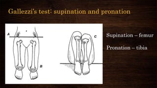 Gallezzi’s test: supination and pronation
Supination – femur
Pronation – tibia
 