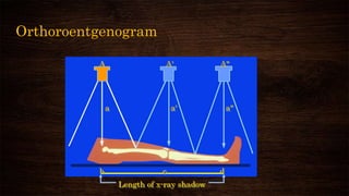 Orthoroentgenogram
Length of x-ray shadow
A A A
a a a
b c d
 