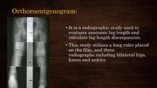 Orthoroentgenogram:
• It is a radiographic study used to
evaluate anatomic leg length and
calculate leg-length discrepancies.
• This study utilises a long ruler placed
on the film, and three
radiographs including bilateral hips,
knees and ankles
 