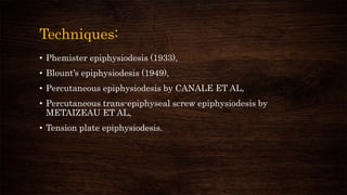 Techniques:
• Phemister epiphysiodesis (1933),
• Blount’s epiphysiodesis (1949),
• Percutaneous epiphysiodesis by CANALE ET AL,
• Percutaneous trans-epiphyseal screw epiphysiodesis by
METAIZEAU ET AL,
• Tension plate epiphysiodesis.
 