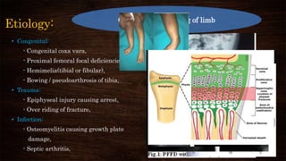Etiology:
• Congenital:
- Congenital coxa vara,
- Proximal femoral focal deficiencies,
- Hemimelia(tibial or fibular),
- Bowing / pseudoarthrosis of tibia,
• Trauma:
- Epiphyseal injury causing arrest,
- Over riding of fracture,
• Infection:
- Osteomyelitis causing growth plate
damage,
- Septic arthritis,
• Neurologic:
- Cerebral palsy,
- Polio,
- Myelodysplasia,
• Tumours:
- Multiple exostosis,
- Fibrous dysplasia,
• Idiopathic unilateral hypoplasia
Causes for shortening of limb
 