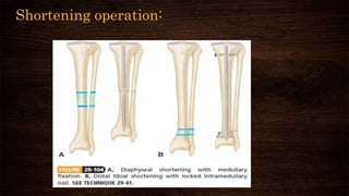 Shortening operation:
 