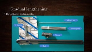 Gradual lengthening :
• By Orthofix: Instruments.
C D unit
Conical pins
Clamp
Rail
schanz pin
 
