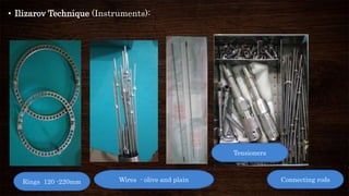 • Ilizarov Technique (Instruments):
Rings 120 -220mm
Tensioners
Wires - olive and plain Connecting rods
 