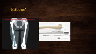 Fitbone:
 