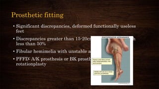 Prosthetic fitting
• Significant discrepancies, deformed functionally useless
feet
• Discrepancies greater than 15-20cm and femoral length
less than 50%
• Fibular hemimelia with unstable ankle
• PFFD: A/K prosthesis or BK prosthesis with Van Nes
rotationplasty
 