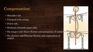 Compensation:
• Shoulder tilt,
• Unequal arm swing,
• Pelvic tilt,
• Scoliosis towards same side,
• On longer side( Knee flexion and pronation of ankle),
• On shorter side(Plantar flexion and supination of
ankle).
 