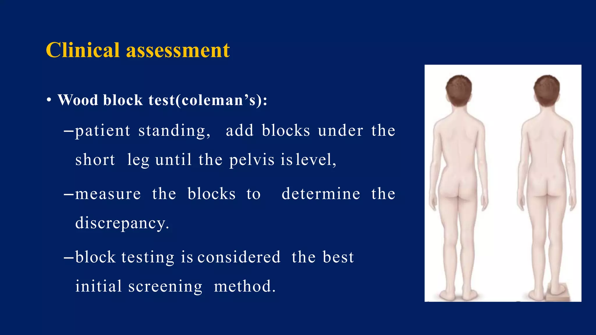 Clinical assessment
• Wood block test(coleman’s):
–patient standing, add blocks under the
short leg until the pelvis is level,
–measure the blocks to determine the
discrepancy.
–block testing is considered the best
initial screening method.
 