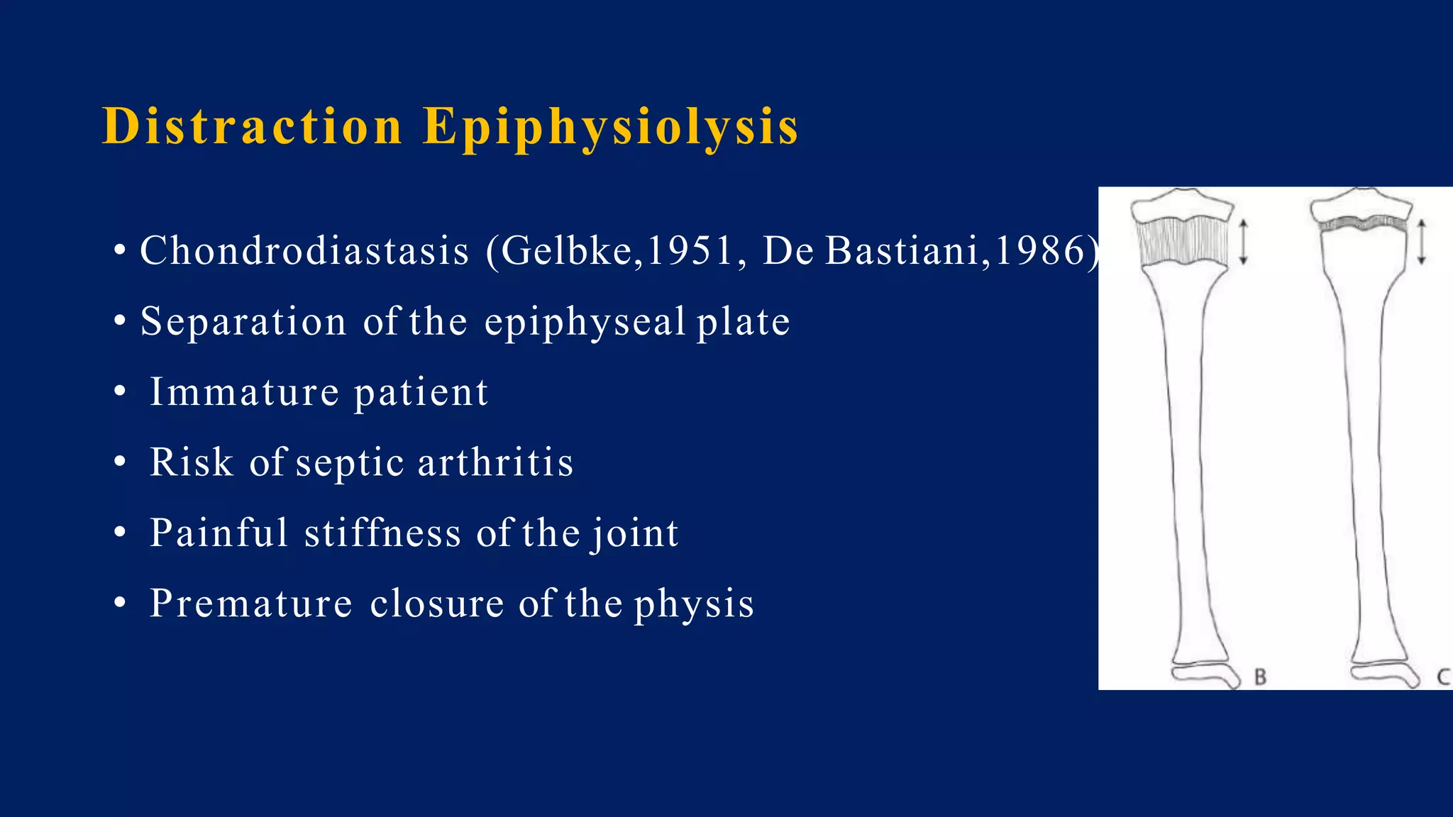 Distraction Epiphysiolysis
• Chondrodiastasis (Gelbke,1951, De Bastiani,1986)
• Separation of the epiphyseal plate
• Immature patient
• Risk of septic arthritis
• Painful stiffness of the joint
• Premature closure of the physis
 