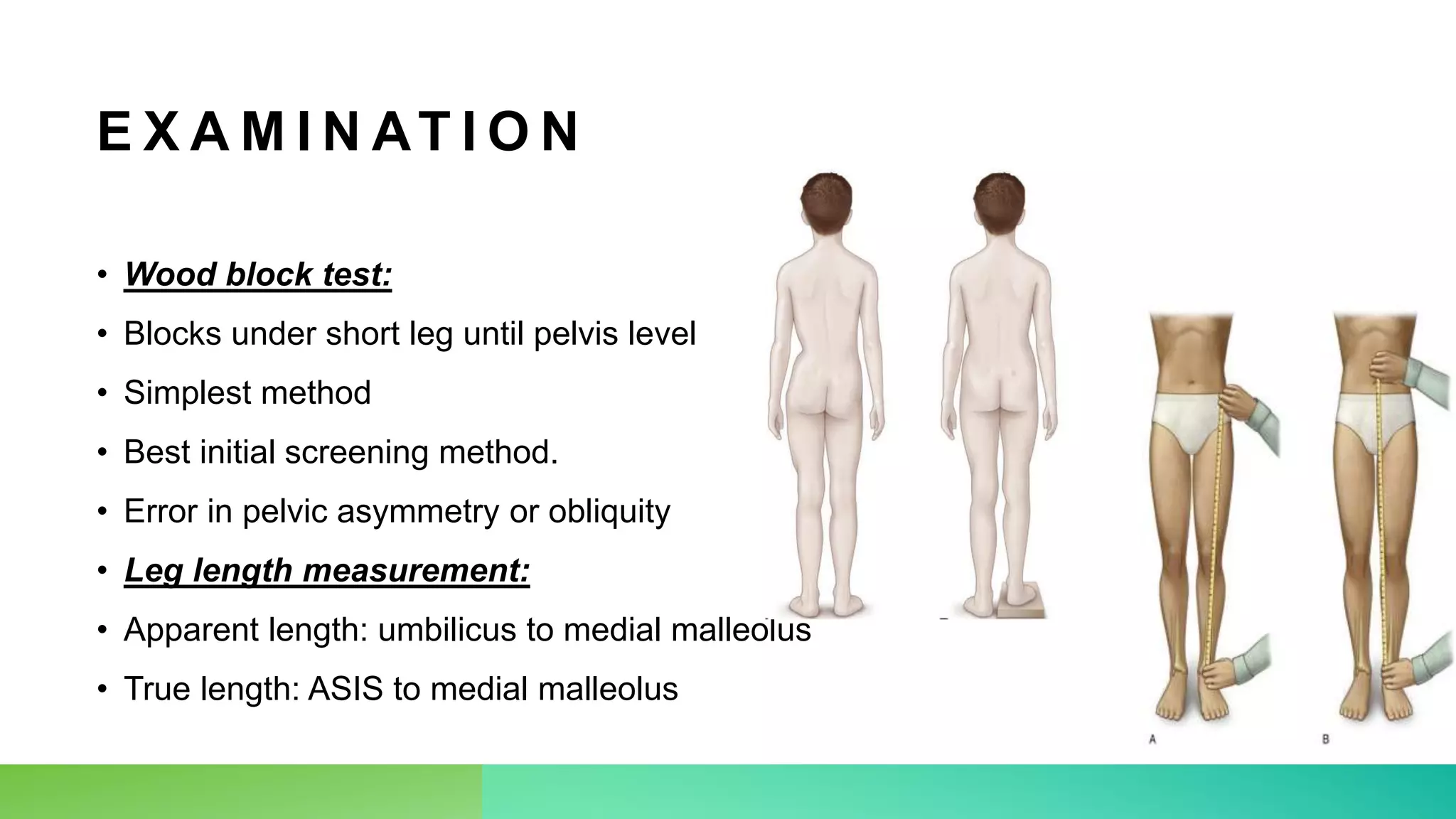 Limb Length Discrepancy.pptx