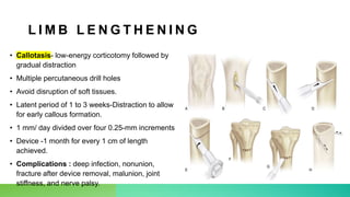 Limb Length Discrepancy.pptx