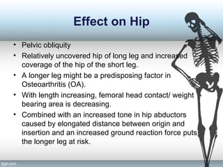 Effect on Hip
• Pelvic obliquity
• Relatively uncovered hip of long leg and increased
coverage of the hip of the short leg.
• A longer leg might be a predisposing factor in
Osteoarthritis (OA).
• With length increasing, femoral head contact/ weight
bearing area is decreasing.
• Combined with an increased tone in hip abductors
caused by elongated distance between origin and
insertion and an increased ground reaction force puts
the longer leg at risk.
 