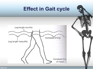 Effect in Gait cycle
 