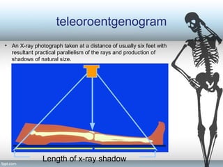 teleoroentgenogram
Length of x-ray shadow
• An X-ray photograph taken at a distance of usually six feet with
resultant practical parallelism of the rays and production of
shadows of natural size.
 