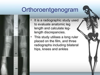Orthoroentgenogram
• It is a radiographic study used
to evaluate anatomic leg
length and calculate leg-
length discrepancies.
• This study utilises a long ruler
placed on the film, and three
radiographs including bilateral
hips, knees and ankles
 