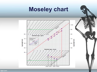 Moseley chart
 