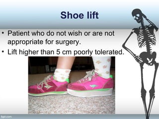Shoe lift
• Patient who do not wish or are not
appropriate for surgery.
• Lift higher than 5 cm poorly tolerated.
 