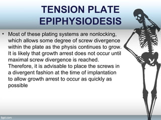 TENSION PLATE
EPIPHYSIODESIS
• Most of these plating systems are nonlocking,
which allows some degree of screw divergence
within the plate as the physis continues to grow.
It is likely that growth arrest does not occur until
maximal screw divergence is reached.
Therefore, it is advisable to place the screws in
a divergent fashion at the time of implantation
to allow growth arrest to occur as quickly as
possible
 