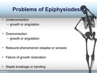 Problems of Epiphysiodesis
• Undercorrection
– growth or angulation
• Overcorrection
– growth or angulation
• Rebound phenomenon (staples or screws)
• Failure of growth restoration
• Staple breakage or bending
 