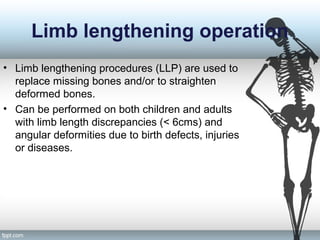 Limb lengthening operation
• Limb lengthening procedures (LLP) are used to
replace missing bones and/or to straighten
deformed bones.
• Can be performed on both children and adults
with limb length discrepancies (< 6cms) and
angular deformities due to birth defects, injuries
or diseases.
 