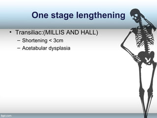 One stage lengthening
• Transiliac:(MILLIS AND HALL)
– Shortening < 3cm
– Acetabular dysplasia
 