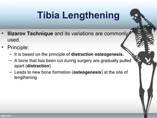 Tibia Lengthening
• Ilizarov Technique and its variations are commonly
used.
• Principle:
– It is based on the principle of distraction osteogenesis.
– A bone that has been cut during surgery are gradually pulled
apart (distraction)
– Leads to new bone formation (osteogenesis) at the site of
lengthening
 