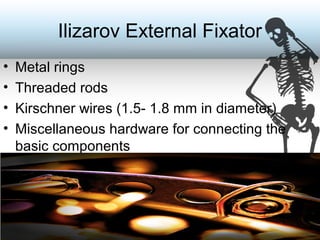 Ilizarov External Fixator
• Metal rings
• Threaded rods
• Kirschner wires (1.5- 1.8 mm in diameter)
• Miscellaneous hardware for connecting the
basic components
 