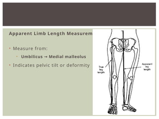 ASSESSMENT OF LIMB LENGTH DISCRIPPANCY .pptx