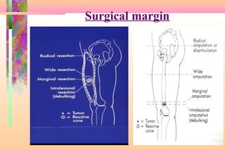 Limb salvage of lower extremity | PPT