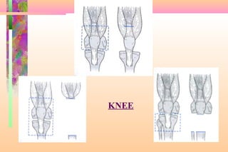 Limb salvage of lower extremity | PPT