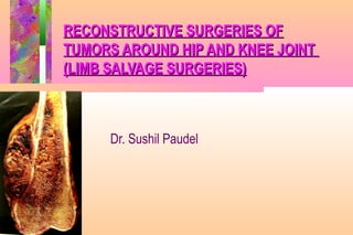 RECONSTRUCTIVE SURGERIES OFRECONSTRUCTIVE SURGERIES OF
TUMORS AROUND HIP AND KNEE JOINTTUMORS AROUND HIP AND KNEE JOINT
(LIMB SALVAGE SURGERIES)(LIMB SALVAGE SURGERIES)
Dr. Sushil Paudel
 