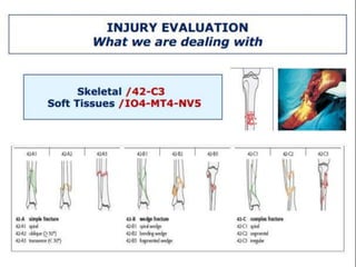 Limb salvage vs amputation final | PPTX