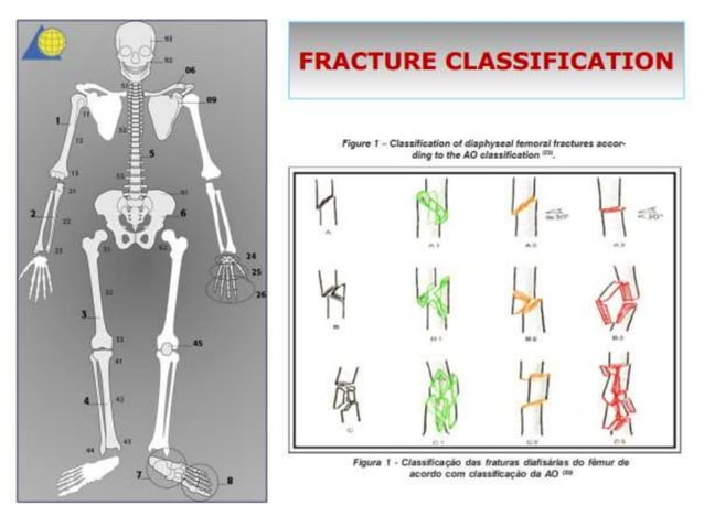 Limb salvage vs amputation final | PPTX | Death, Injury, or Military ...
