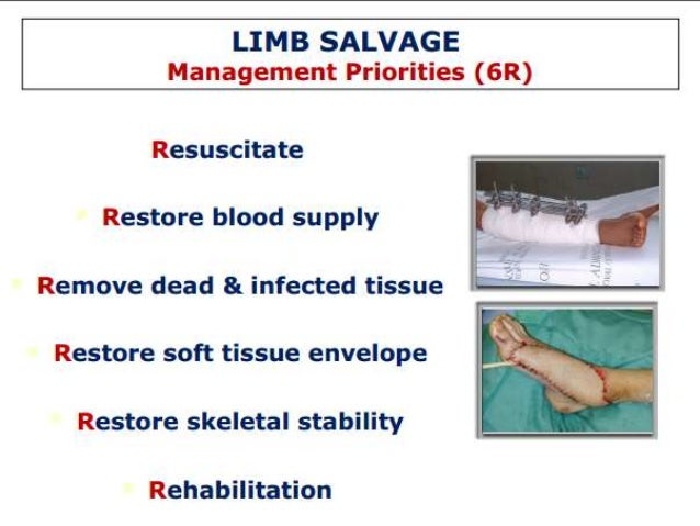 Surgical Approach: Limb Salvage Versus Amputation – YSKUT