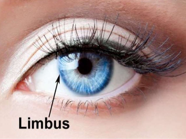 Limbus